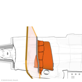 Graphic Reusable Scatter Reducing Drape with Radial Access - Deutsch Medical