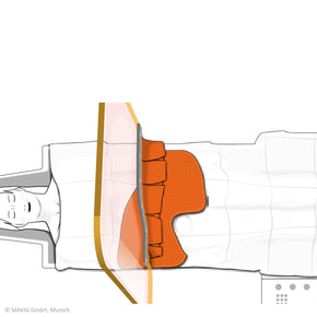 Graphic Reusable Scatter Reducing Drape with Femoral Access - Deutsch Medical